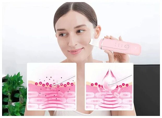 Аппарат для ультразвуковой чистки кожи Inface MS7100 RU (Pink) - 5
